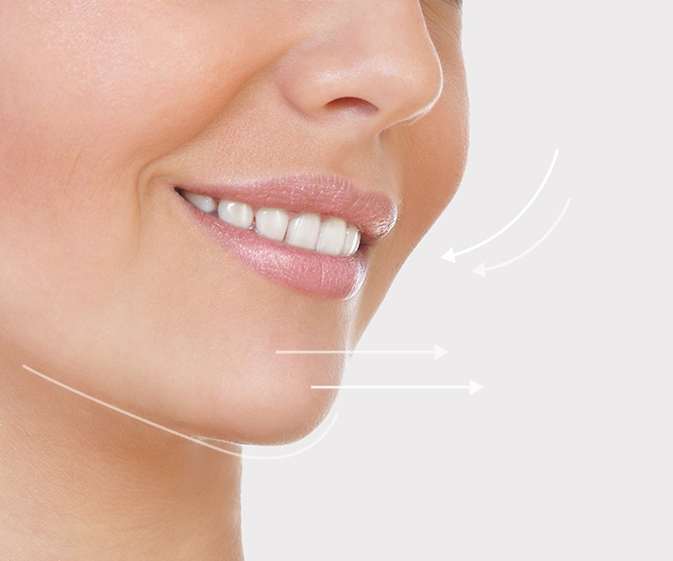 치아 교정 이미지