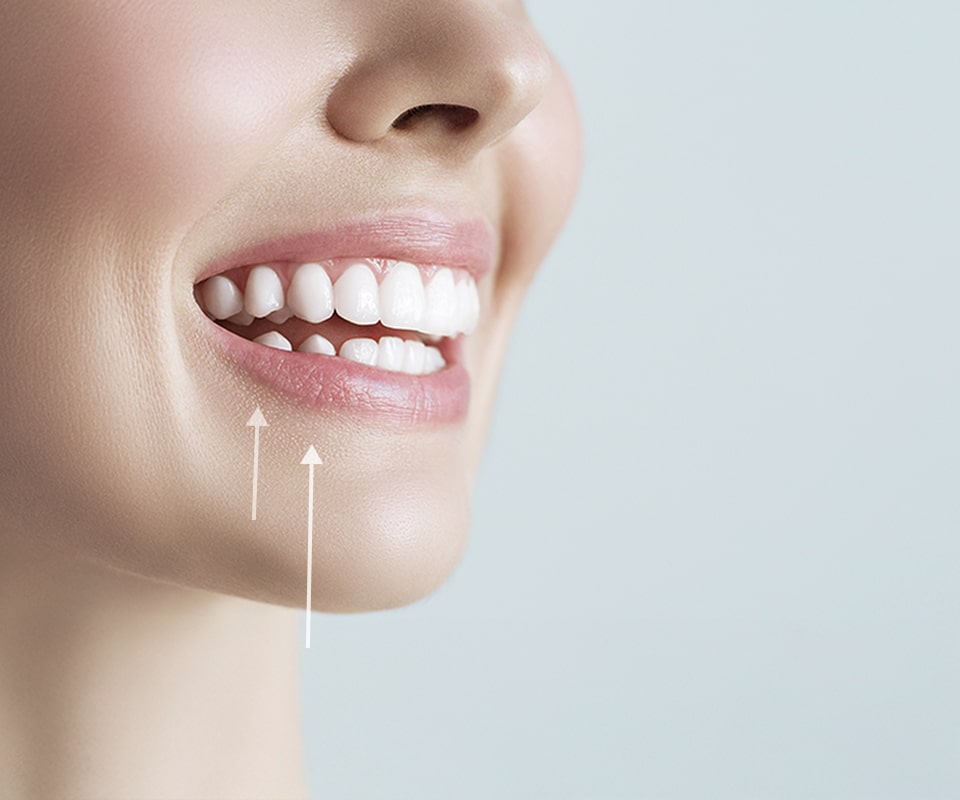 치아 교정 이미지