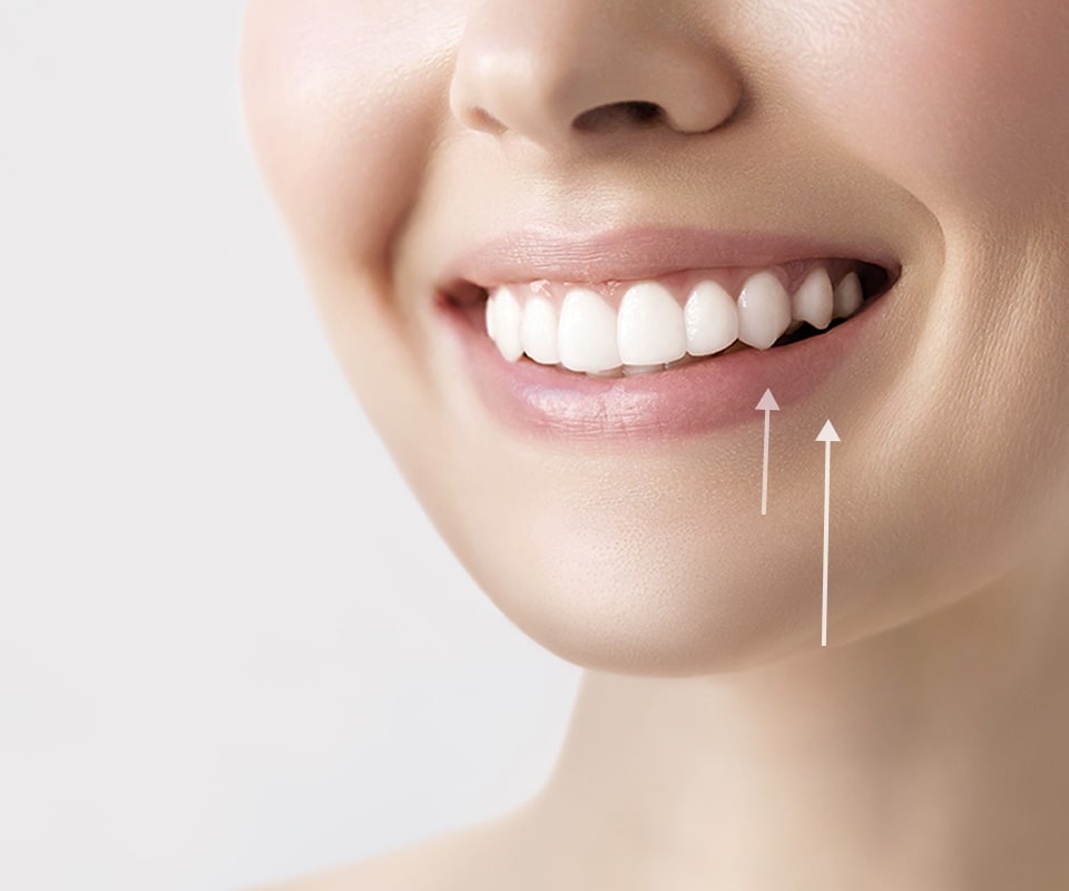 치아 교정 이미지