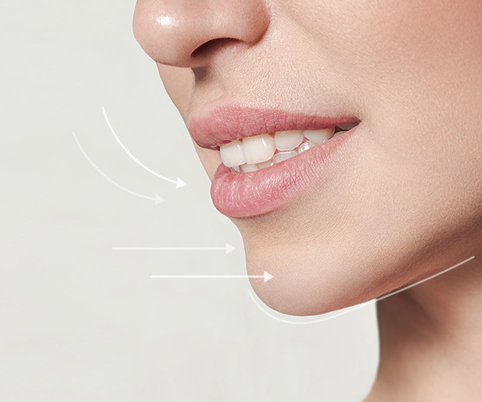 치아 교정 이미지