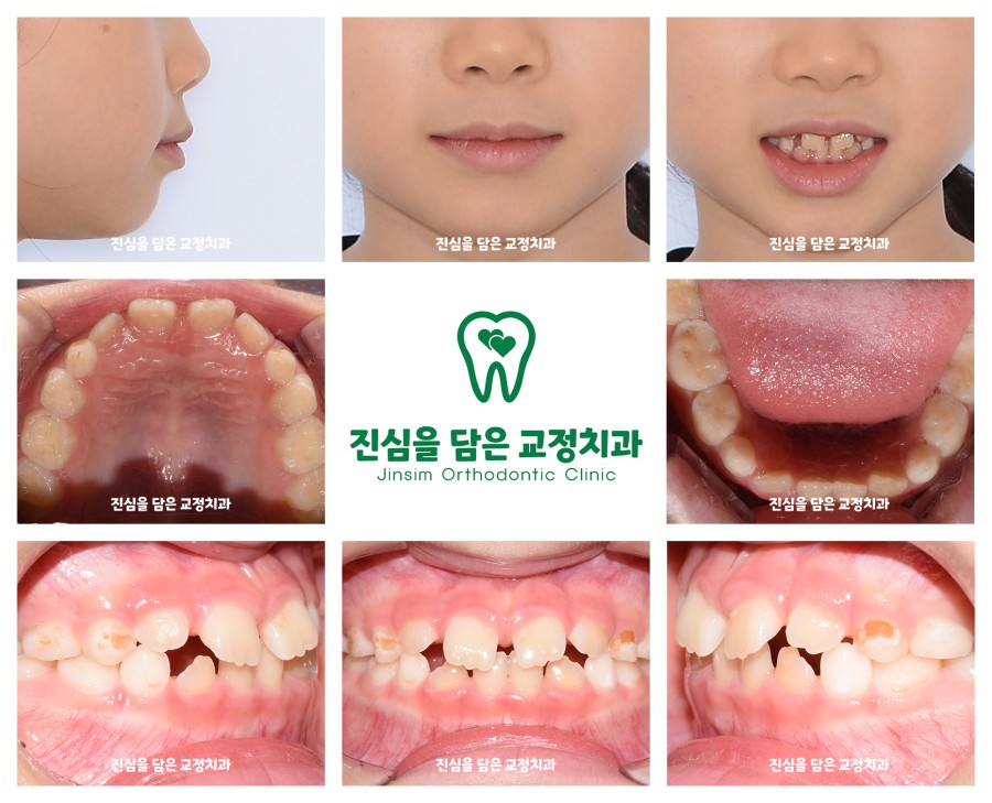 (1)김다인퍼스트_초진 사진.jpg