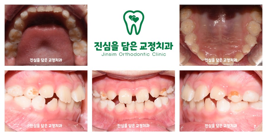 (2)김다인퍼스트_진행과정.jpg