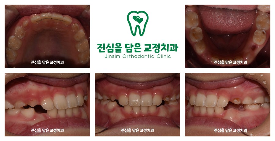 (3)김다인퍼스트_마무리.jpg