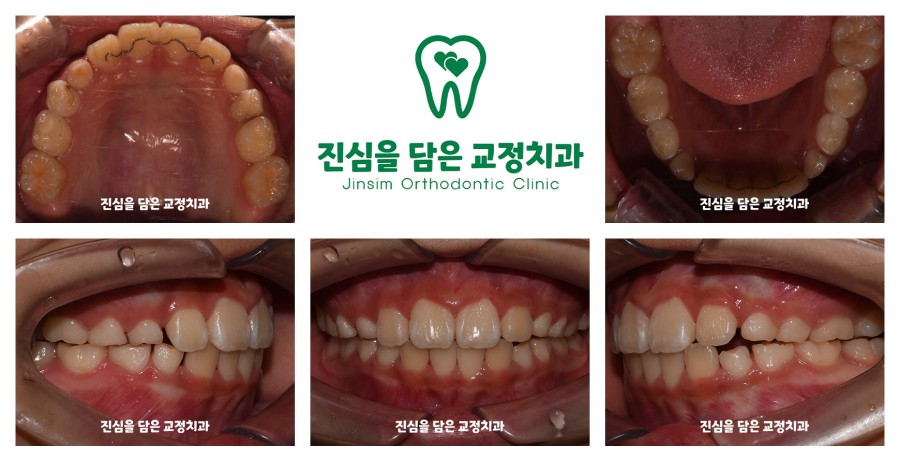(3) 마무리(신유빈_퍼스트).jpg