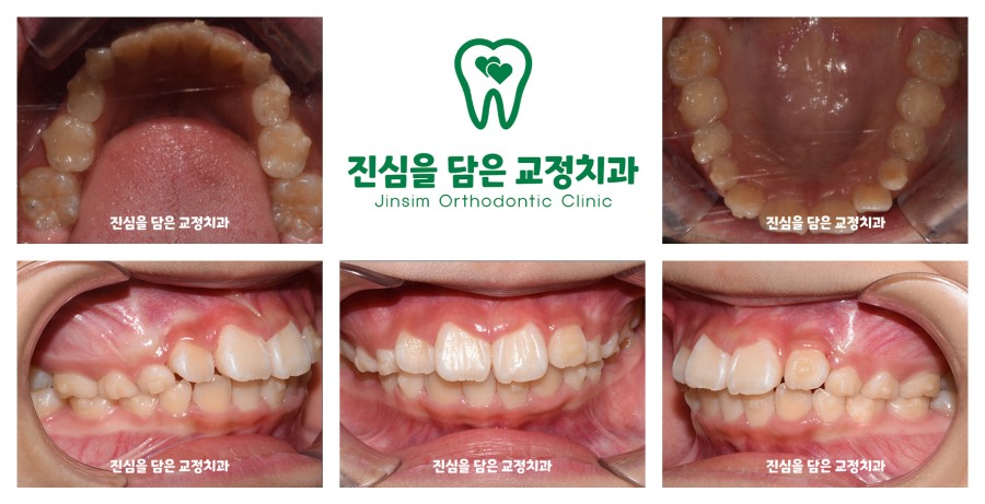 (2) 진행 과정(신유빈_퍼스트).jpg