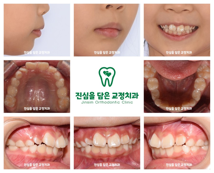 (1) 초진 사진(신유빈_퍼스트).jpg